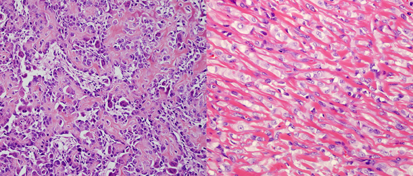 Bone and Soft Tissue Pathology